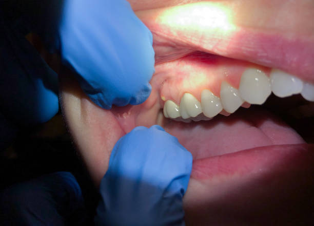 Best Emergency Orthodontic Repairs in Oswego, KS